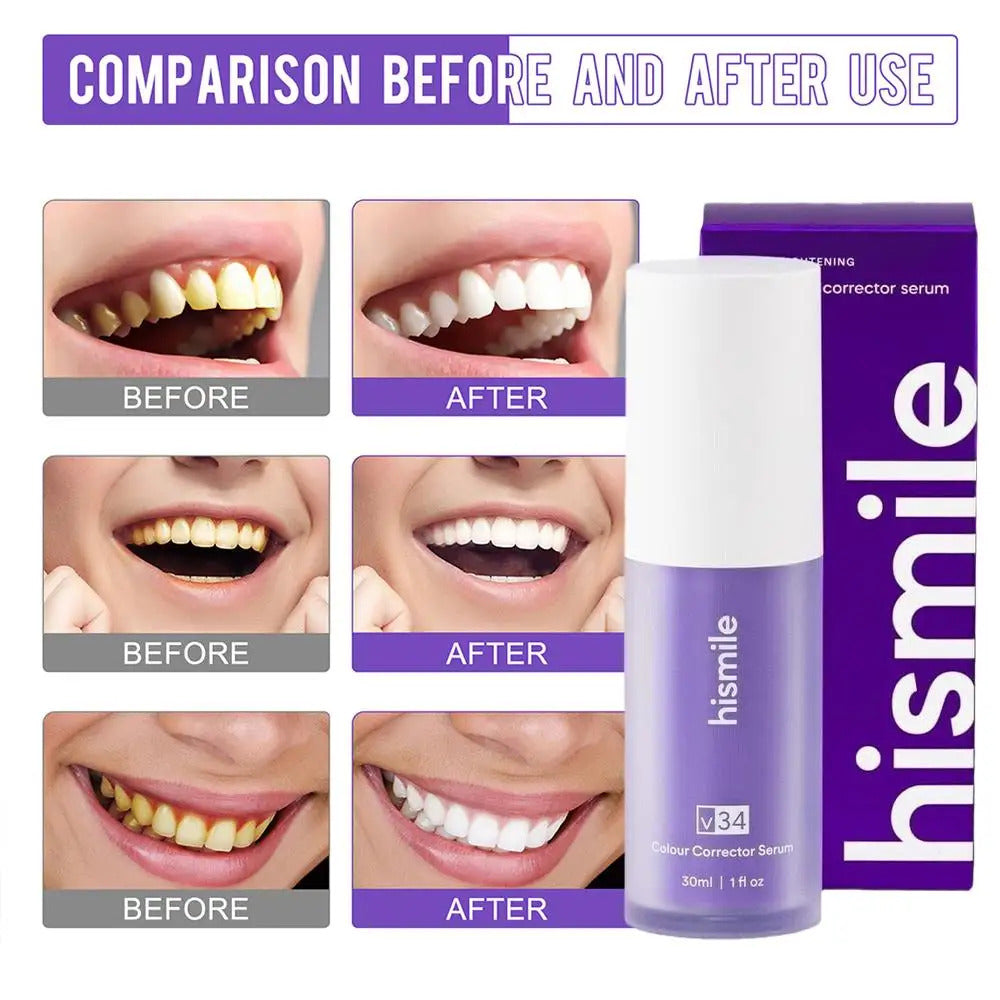 HiSmile V34™ – No More Yellow Stains, Just Bright Smiles